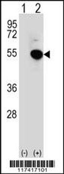 IRF4 Antibody (Center)