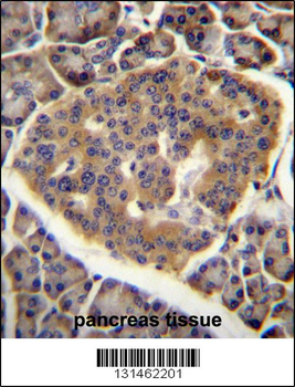 CO040 Antibody (C-term)