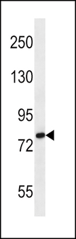SLC9A2 Antibody (C-term)