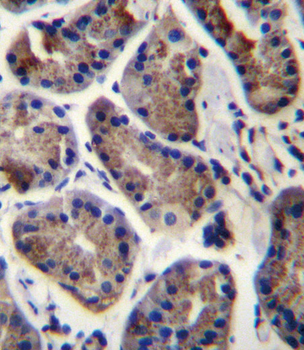 SLC9A2 Antibody (C-term)