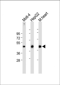 LPAR6 Antibody (Center)
