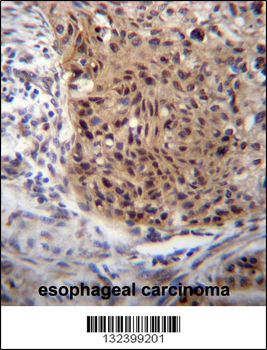 EXTL3 Antibody (N-term)