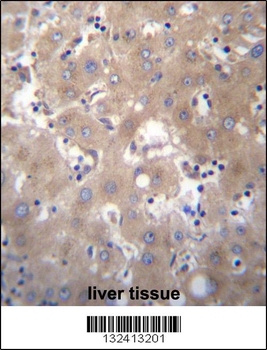 SIX5 Antibody (Center)