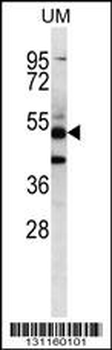 PNLIPRP3 Antibody (N-term)