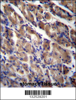 ABRA Antibody (C-term)