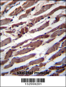 PUS1 Antibody (C-term)