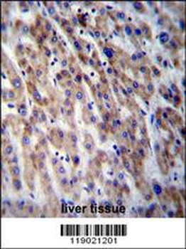 CPN1 Antibody (Center)