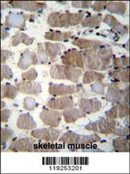 CTSK Antibody (Center E112)
