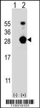 FKBP7 Antibody (C-term)