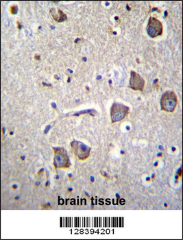 NRN1L Antibody (Center)