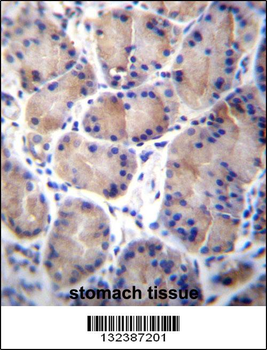 CES8 Antibody (C-term)