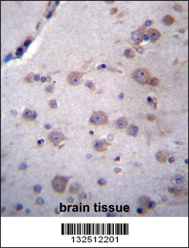 NDUFAF4 Antibody (N-term)