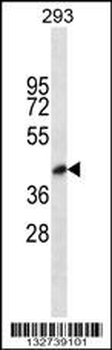 BVES Antibody (C-term)