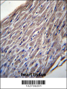 BVES Antibody (C-term)