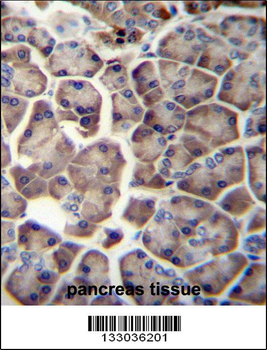 WDR12 Antibody (Center)