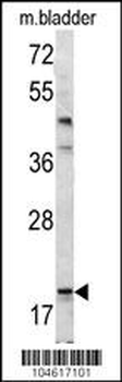 Bad BH3 Domain Antibody