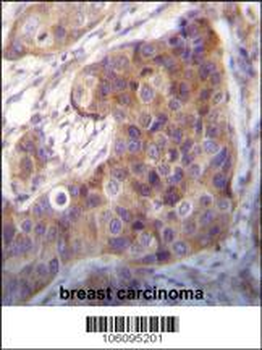 Bit1 Antibody (Center)