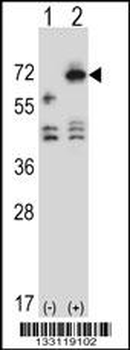 ARSF Antibody (Center)