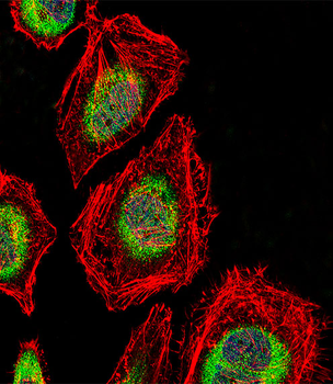 NRK Antibody (Center)