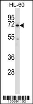BTK Antibody (N-term)