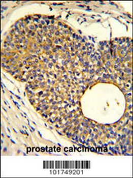 PHO1 Antibody (N-term)