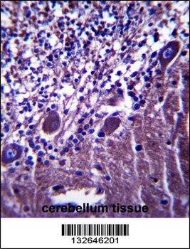 PLXNC1 Antibody (C-term)