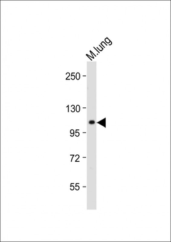 RHBDF2 Antibody (N-term)