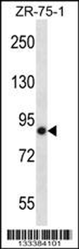 LRRN4 Antibody (C-term)