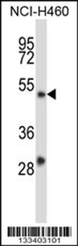 YY2 Antibody (C-term)