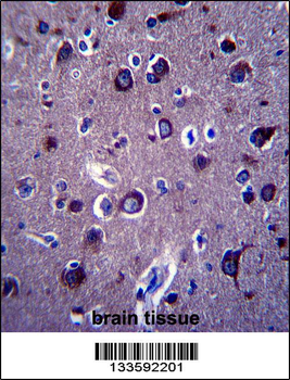 APP Antibody (Center)
