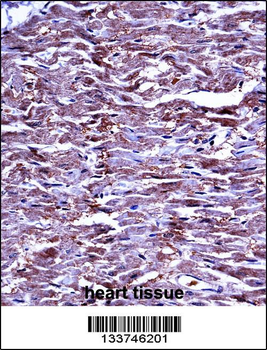MMP15 Antibody (N-term)