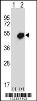 NR0B1 Antibody (Center)