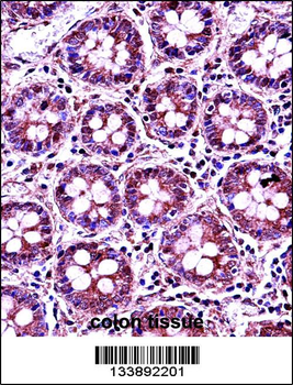 RANGAP1 Antibody (N-term)