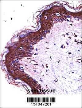 S100A7 Antibody (N-term)