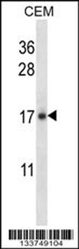 IL21 Antibody (C-term)