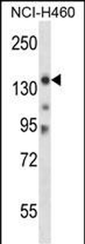 Mouse Myo3b Antibody (N-term)