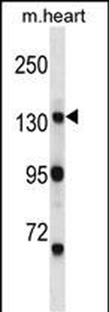 Mouse Myo3b Antibody (N-term)