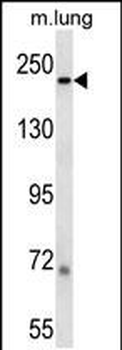 LAMB1 Antibody (C-term)