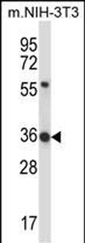 HEXIM1 Antibody (N-term)