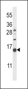 NPPC Antibody (C-term)