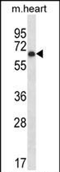 Mouse Pkmyt1 Antibody (N-term)
