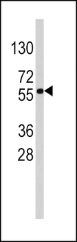 SOX9 Antibody (Center)