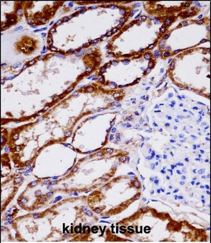 NDUFAB1 Antibody (C-term)