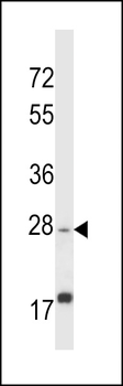 APOOL Antibody (C-term)