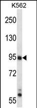 Mouse Map3k10 Antibody (N-term)
