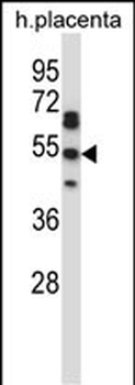 TEAD2 Antibody (Center)