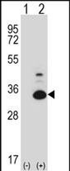 Mouse Tp53rk Antibody (Center)