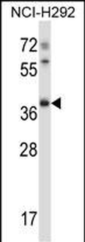 Mouse Tssk6 Antibody (C-term)