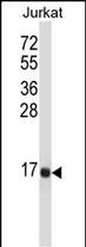 TAC3 Antibody (Center)