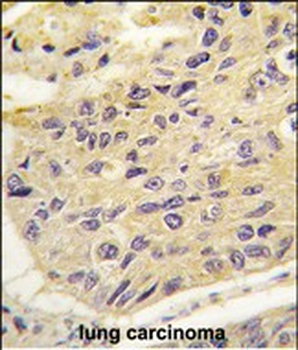 FRAT1 Antibody (Center)
